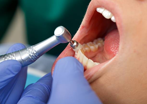 Laser Dentistry in Hudson, WI